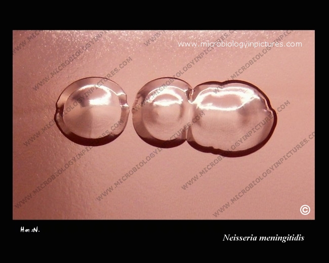 Neisseria meningitidis colonies, cultivation 48 hours neisseria meningitidis raised colonies